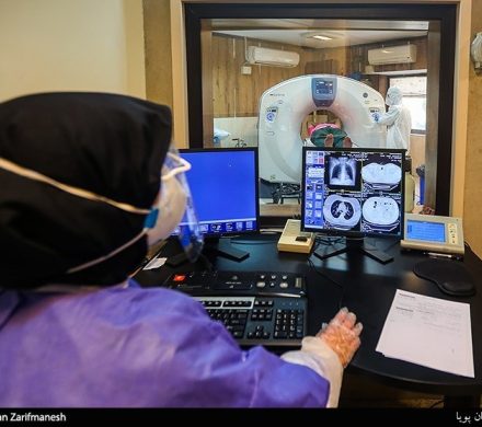 پشت پرده تجویزهای بیحساب و کتاب تصویربرداریهای پزشکی در ایران/دلایل فرسودگی تجهیزات رادیولوژی