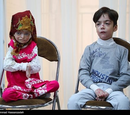 تخمین وجود ۳ میلیون بیمار نادر در کشور/عدم اجرای سند ملی بیماری در ۳ دولت/صندوق بیماران خاص رنج بیماران نادر را کم نکرد